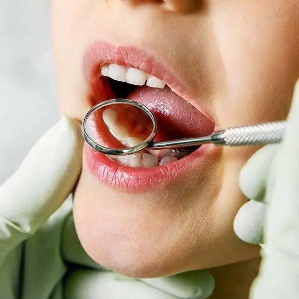 Dental exams and cleanings Greenspoint Houston TX