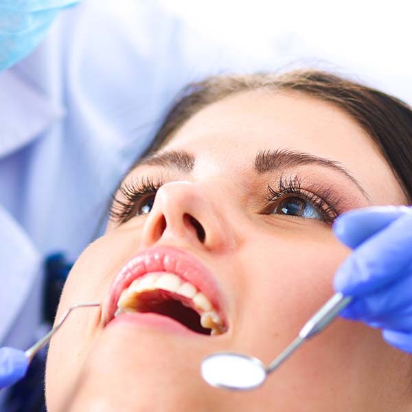 Houston dental cleanings